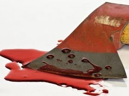 Sister-in-law's nose cut off with an ax