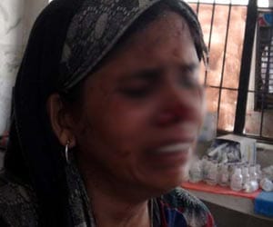 Sister-in-law's nose cut off with an ax