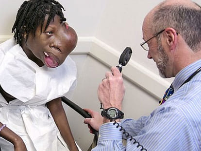 girl with a tumour on her face