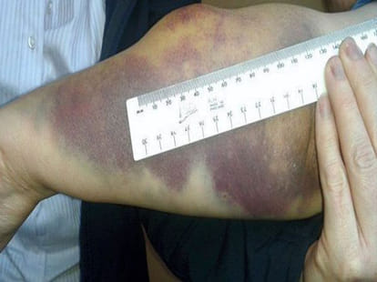 women punched a stranger 30 times and bit him for no reason
