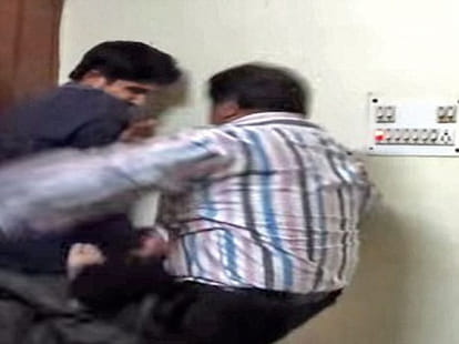 boy beaten badly by dad after a prank