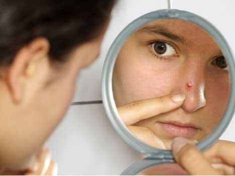 dark pimple can be a sign of skin cancer