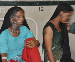 acid attack on mother and daughter