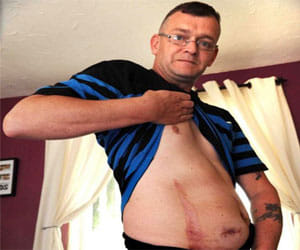man's stomach cathches fire