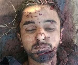 Dead Body of Young Man Found in Suspensive Conditions