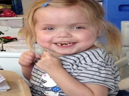 girl living after 38 operations at the age of 6