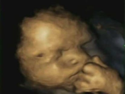 women who went into 75 days of labor pain