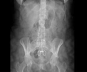 Digital X ray facility start in goverment hospitals from new year.
