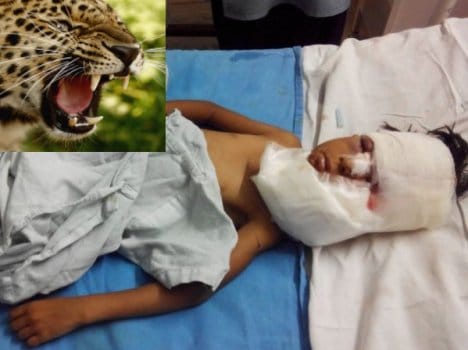 child escaped from leopard mouth
