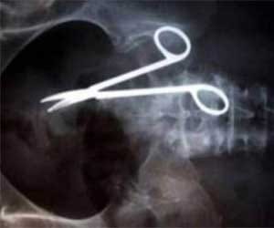 scissors found in man's stomach after nine years of agonising pain