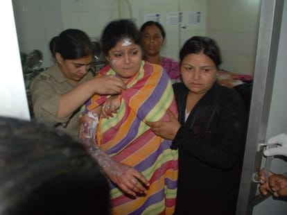 acid attack