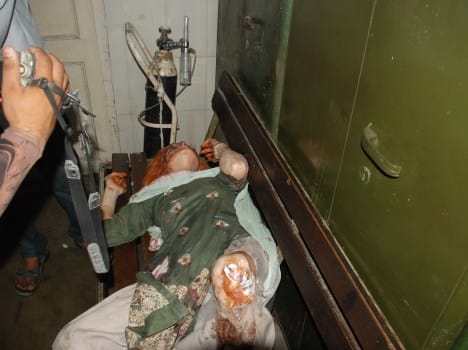 acid attack