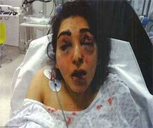 Woman stabbed the woman in cell