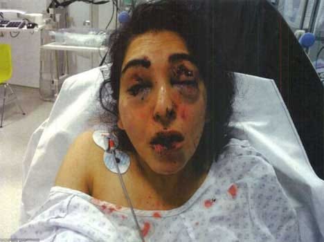 grandfather stabbed daughter in law in eyes for having an affair