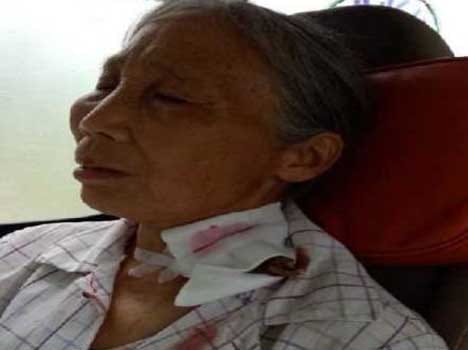 old lady walked 7 miles to reach hospital with tree trunk in neck 