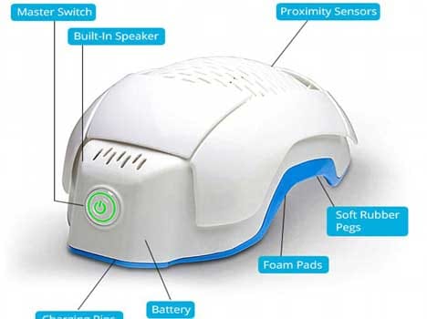 a helmet that can cure baldness