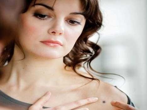 mole can be a sign of breast cancer in women