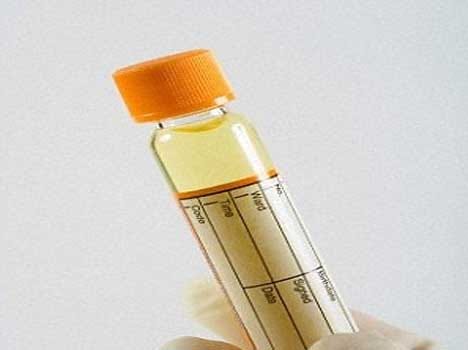 Pee to power your smartphone, tablets, Soon