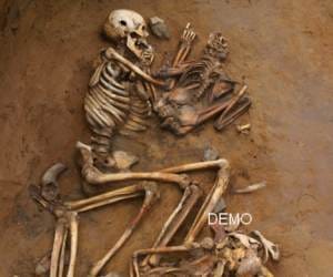 100 Skeleton get in unnao