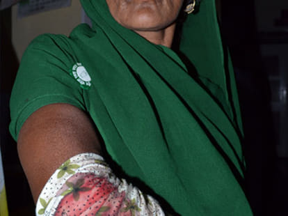 bjp mp attacked in fatehpur