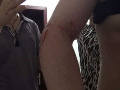 man stuck his hands in toilet for hours to save smartphone