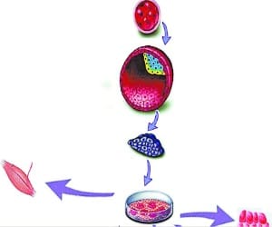 Know about Stem Cell Therapy and its Benefits