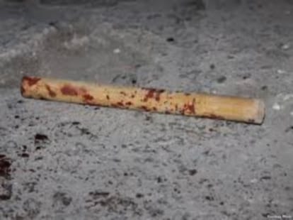Man's penis cut off