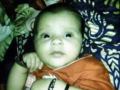 2 month old baby girl died of dog biting