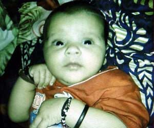 2 month old baby girl died of dog biting