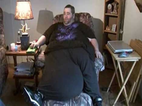 man whose scrotum weighs 45 kilos