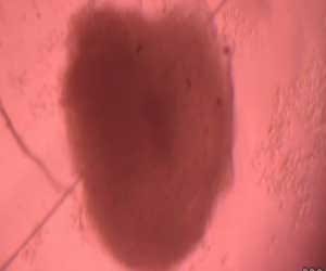 new small heart developed