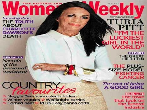 acid attack survivor becomes cover page of a fashion magazine