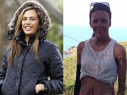 acid attack survivor becomes cover page of a fashion magazine