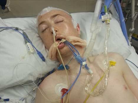 doctors put part of skull in stomach