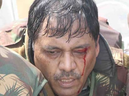 tension in kanth