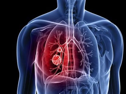 blood cancer treatment is now possible.