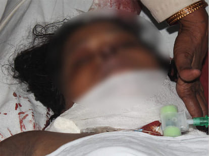 delhi police did encounter in rohtak, kidnaper died
