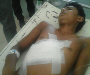 grinding machine entered in the stomach of a young man 