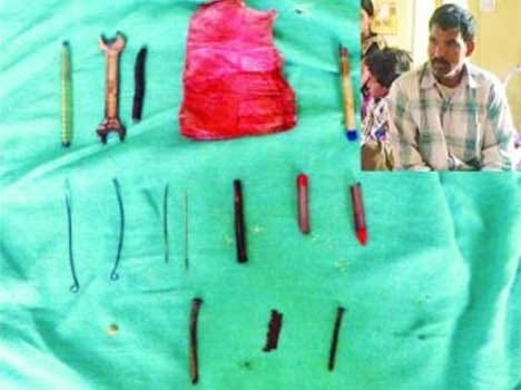 man found with 16 tools in stomach