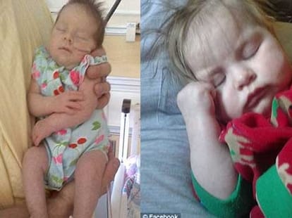 baby born eith static hair, cause lightning