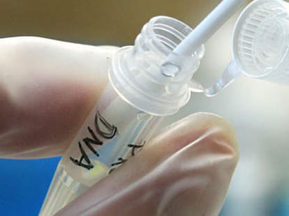 डीएनए टेस्ट