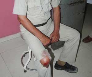 Public attack on police in faridabad