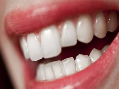 palmisty teeth women samudrashastra 
