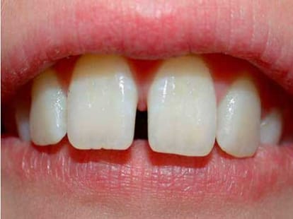 man found with 232 teeths in jaw