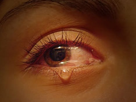 Why is this family weeping tears of blood?