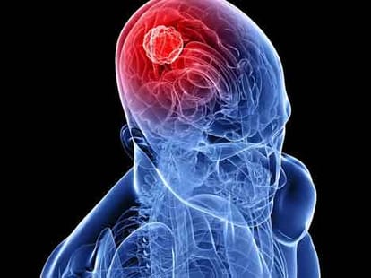 vastu effect cancer disease