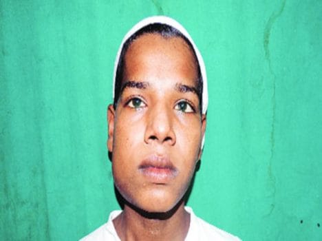 man found with 232 teeths in jaw
