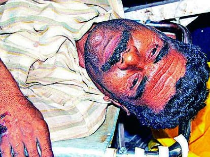 2 dead 1 injured in tractor truck clash