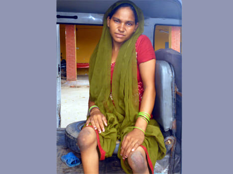  In-laws expelled disable pregnant woman for dowry