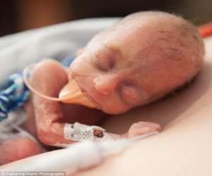 NICU and Sncu of governmental hospitals are full